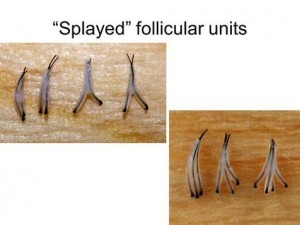 splayed grafts