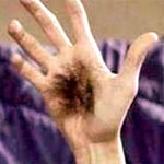Hairy palm