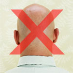 No bald men