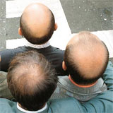 Bald heads